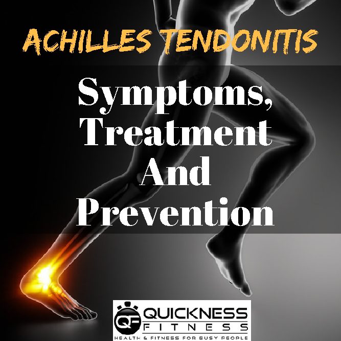 Achilles Tendonitis – Symptoms, Treatment And Prevention